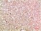 TTR mouse Monoclonal Antibody(6E5)